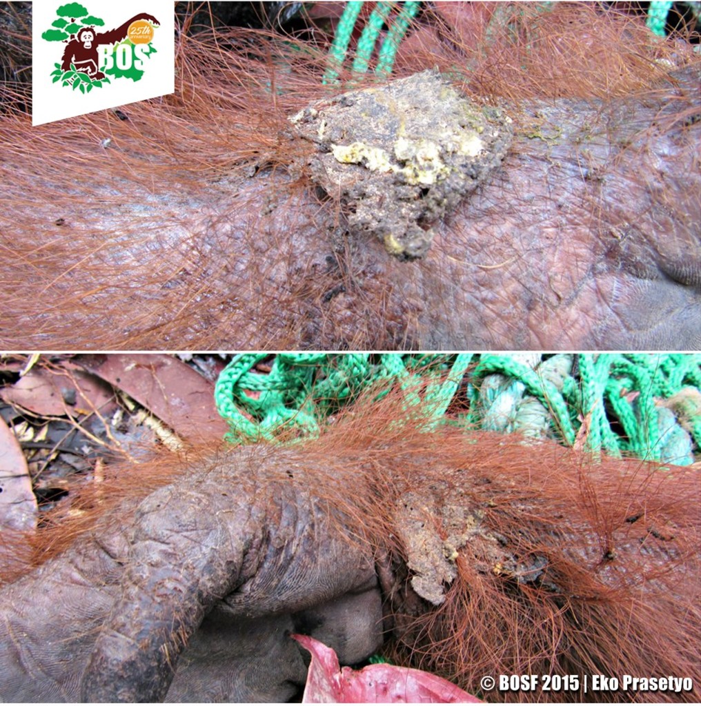 Pantung sap attached to the body of an orangutan suffering from burns.